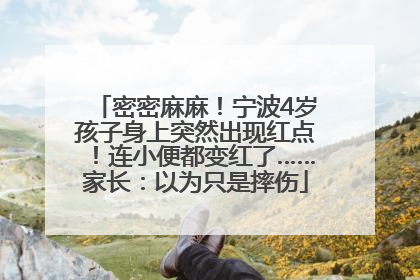 密密麻麻！宁波4岁孩子身上突然出现红点！连小便都变红了……家长：以为只是摔伤